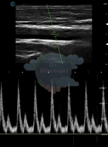 Беспроводная ручная ультразвуковая система Apache L154